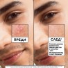 Garnier Pure Active Salicylic 7-Day Clinical Anti-Blemish Serum – Ser clinic anti-imperfecțiuni pentru 7 zile