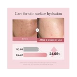 Medicube Pdrn Pink Glutathione Serum Mist – Ser pentru față