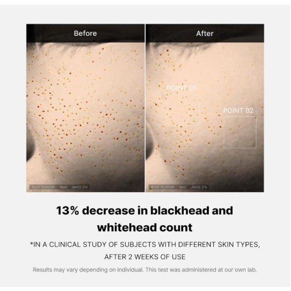 Medicube Zero Pore One Day Serum Ser pentru fata